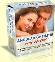 Angular Cheilitis Free Forever
